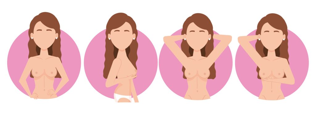 Nipple vasospasm vs thrush