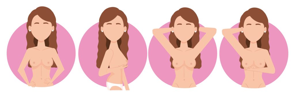 Nipple-Sparing Mastectomy: Everything You Need to Know