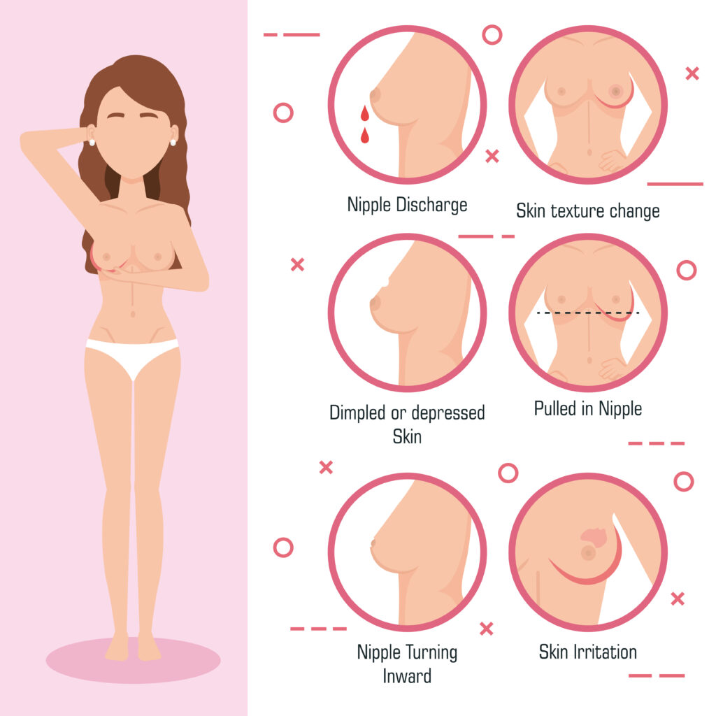 What is Raynaud's Phenomenon of the Nipple? Is nipple vasospasm dangerous?