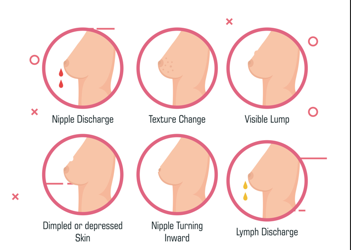 Insufficient glandular tissue: How it impacts the breastfeeding womens