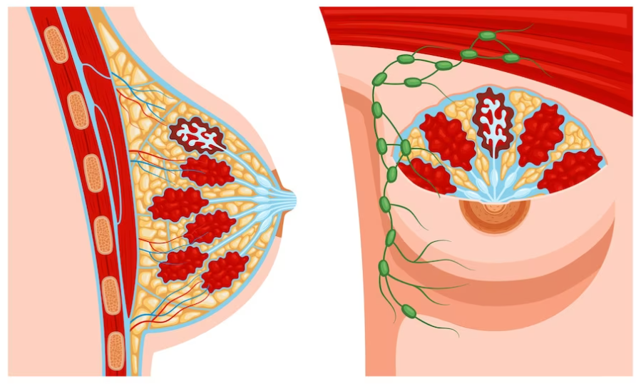 Insufficient glandular tissue: How it impacts the breastfeeding womens